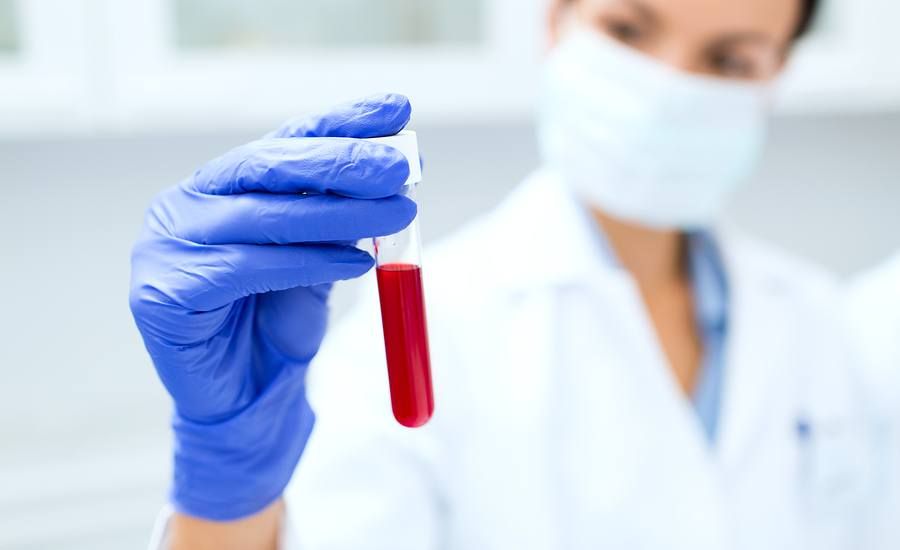 blood alcohol test sample